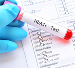 נפיחות בלחי - תמונת אווירה